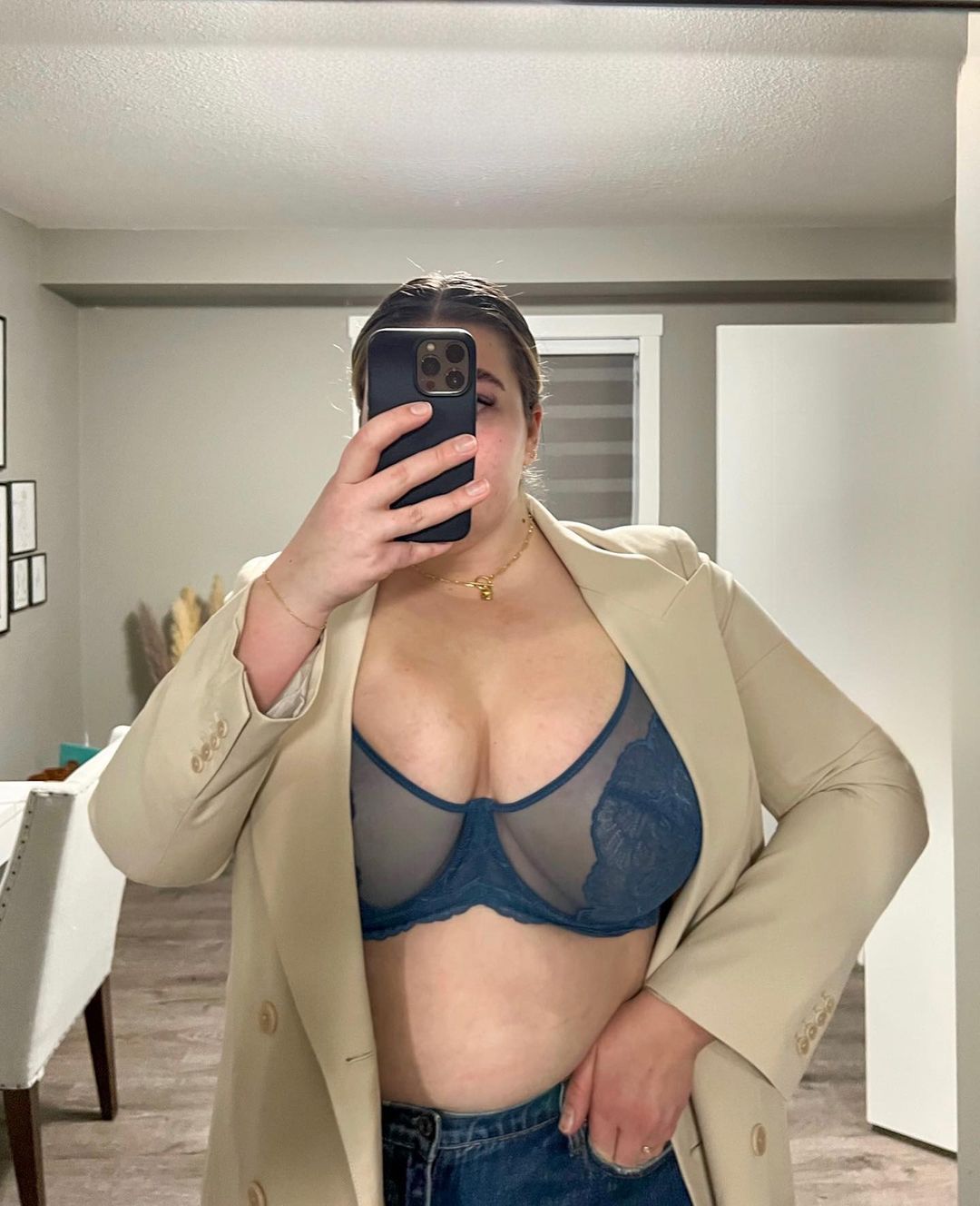 Is it fat? or is it accessory breast? - HSIA